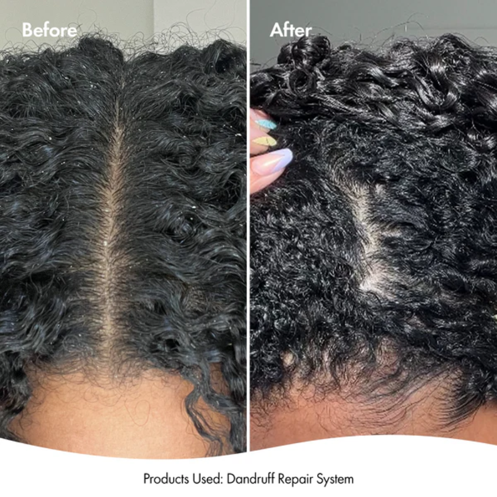 BONDI BOOST Dandruff Repair Leave-In Scalp Serum-125ml | Barber Outlet