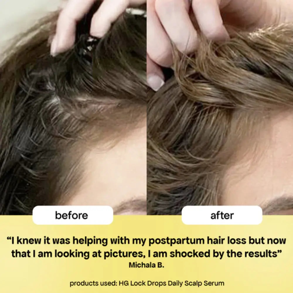 BondiBoost Lock Drops Anti-shedding Scalp & Hair Serum