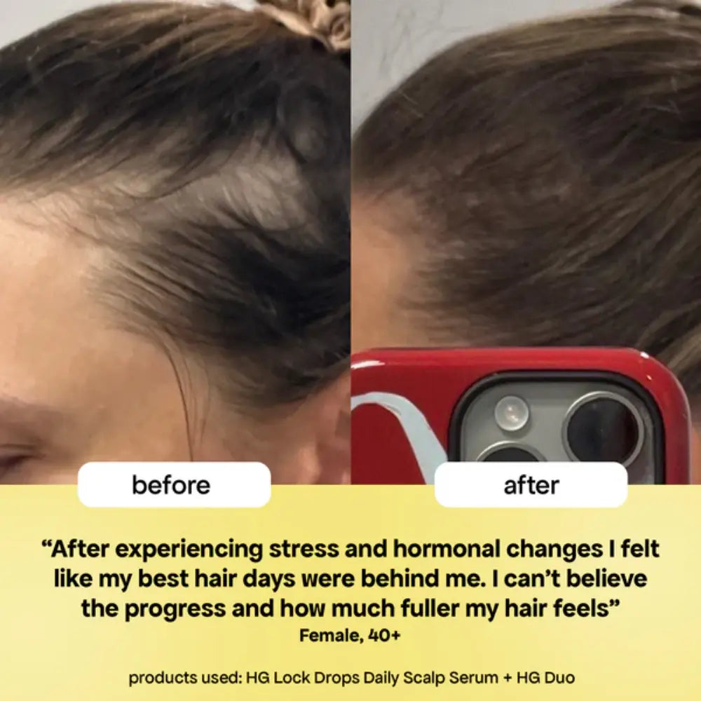 BondiBoost Lock Drops Anti-shedding Scalp & Hair Serum