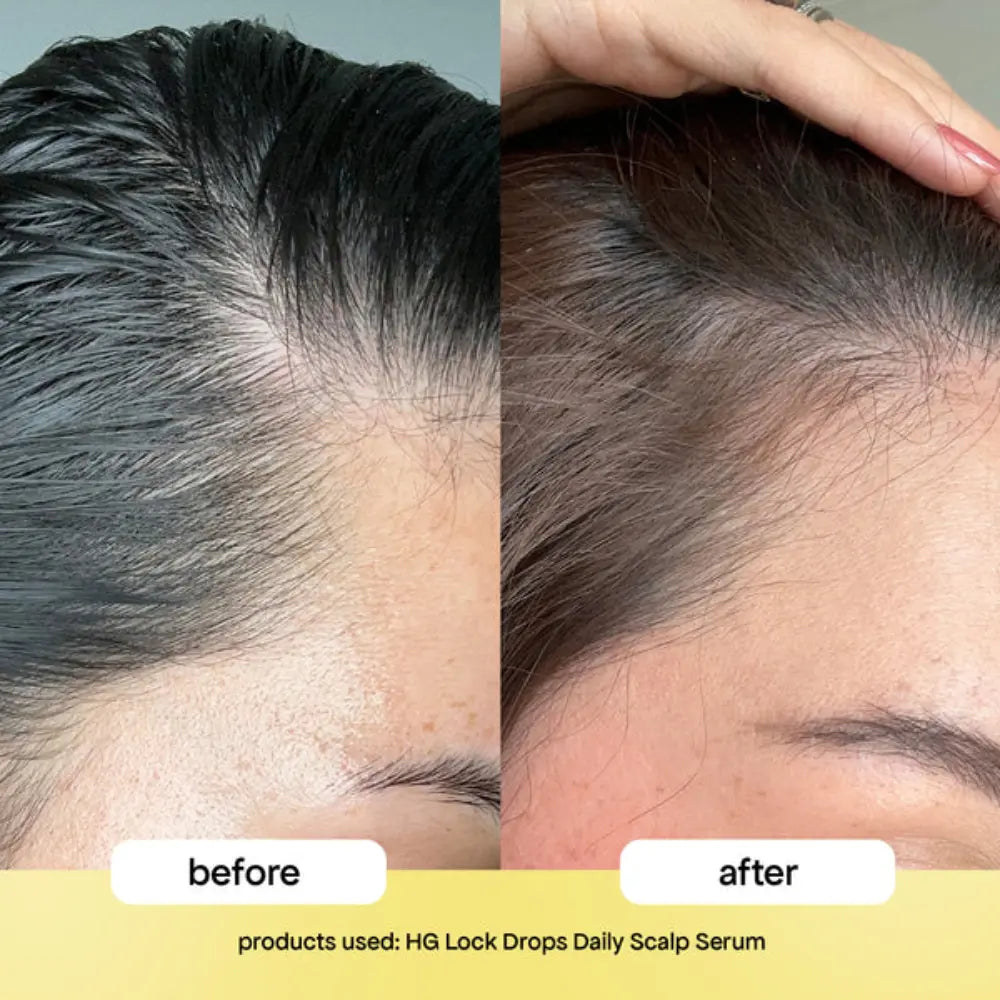 BondiBoost Lock Drops Anti-shedding Scalp & Hair Serum
