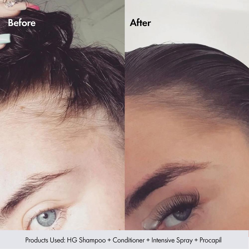 Bondi Boost Hair Growth Trio Set | Barber Outlet