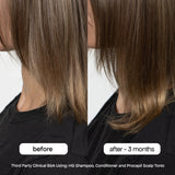 Bondi Boost Hair Growth Shampoo & Conditioner Duo 500 ml