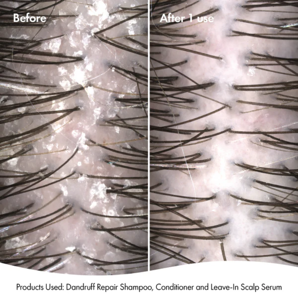 BONDI BOOST Dandruff Repair Leave-In Scalp Serum-125ml | Barber Outlet